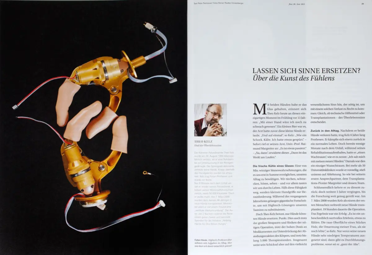 Gold prosthetic hand with exposed wiring against a black background.