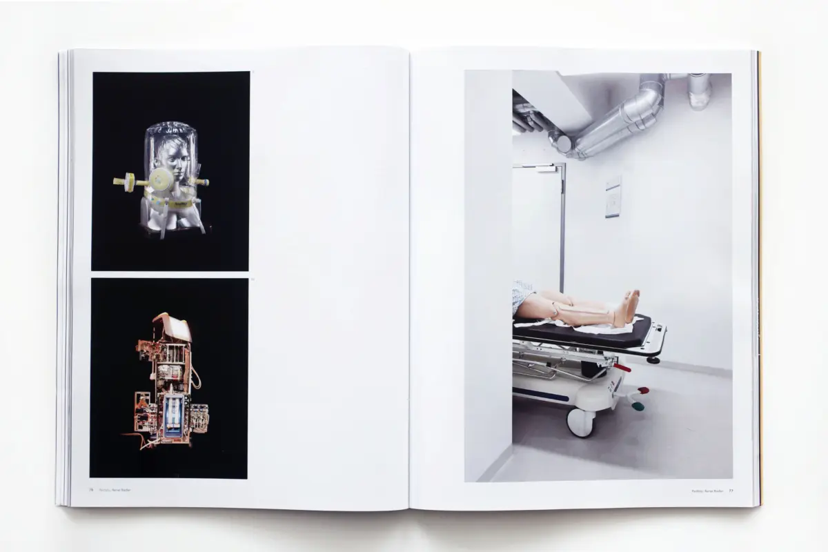 Patient lying on a wheeled hospital stretcher in a sterile clinical room with overhead ducts.