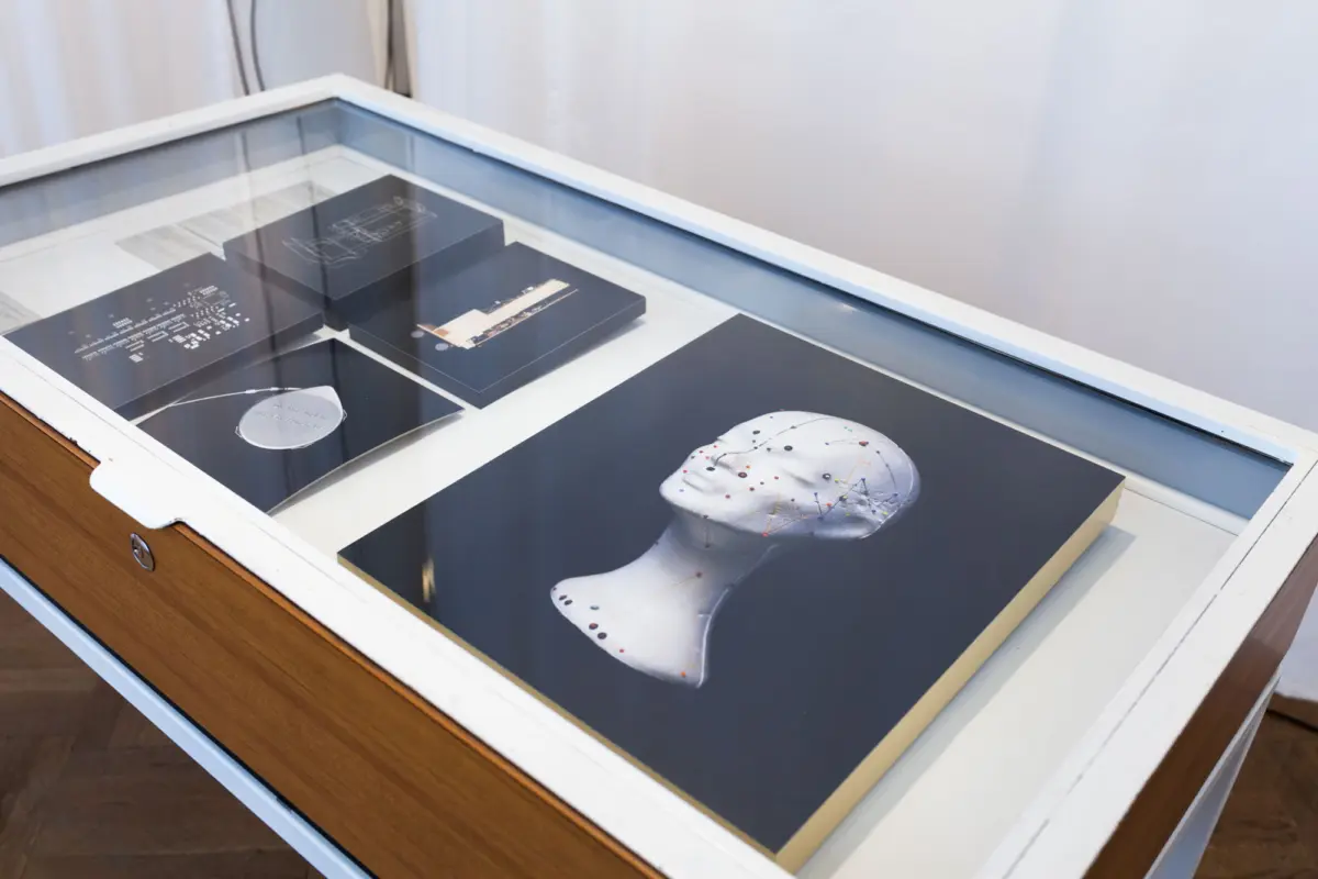 Museum display case with dark diagram panels and a white foot-shaped model marked with colored pins.