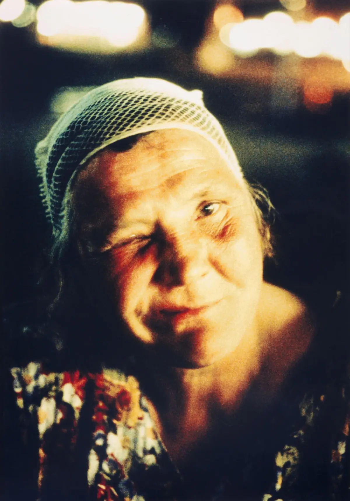 Older person with bruised face wearing a mesh head covering, against blurry nighttime city lights.