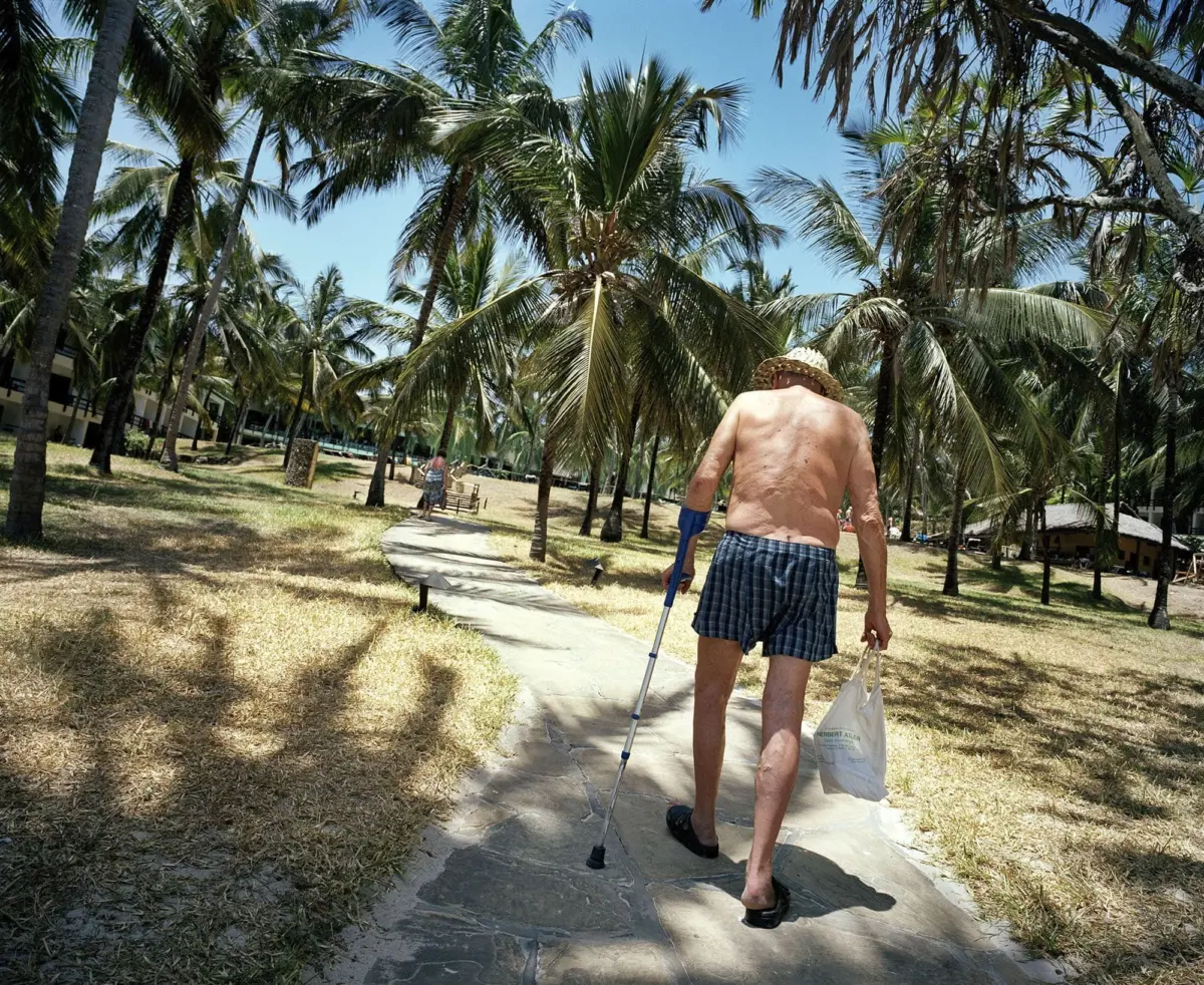 Shirtless adult with a forearm crutch walks along a sunny palm-tree path at a tropical resort, carrying a white bag.