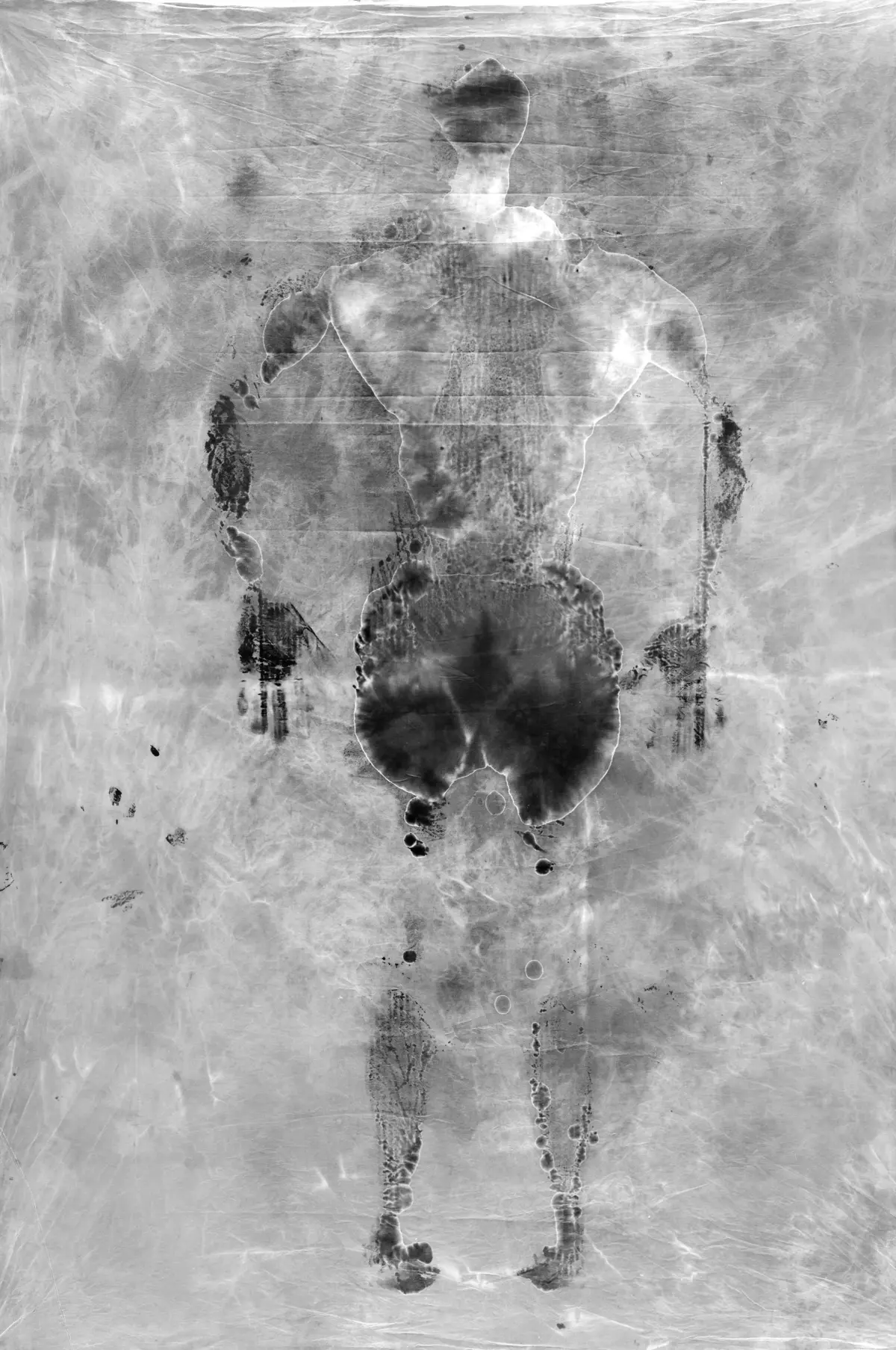 Back-view silhouette of a human standing; grayscale negative with a textured backdrop and dark patches on the back and limbs.