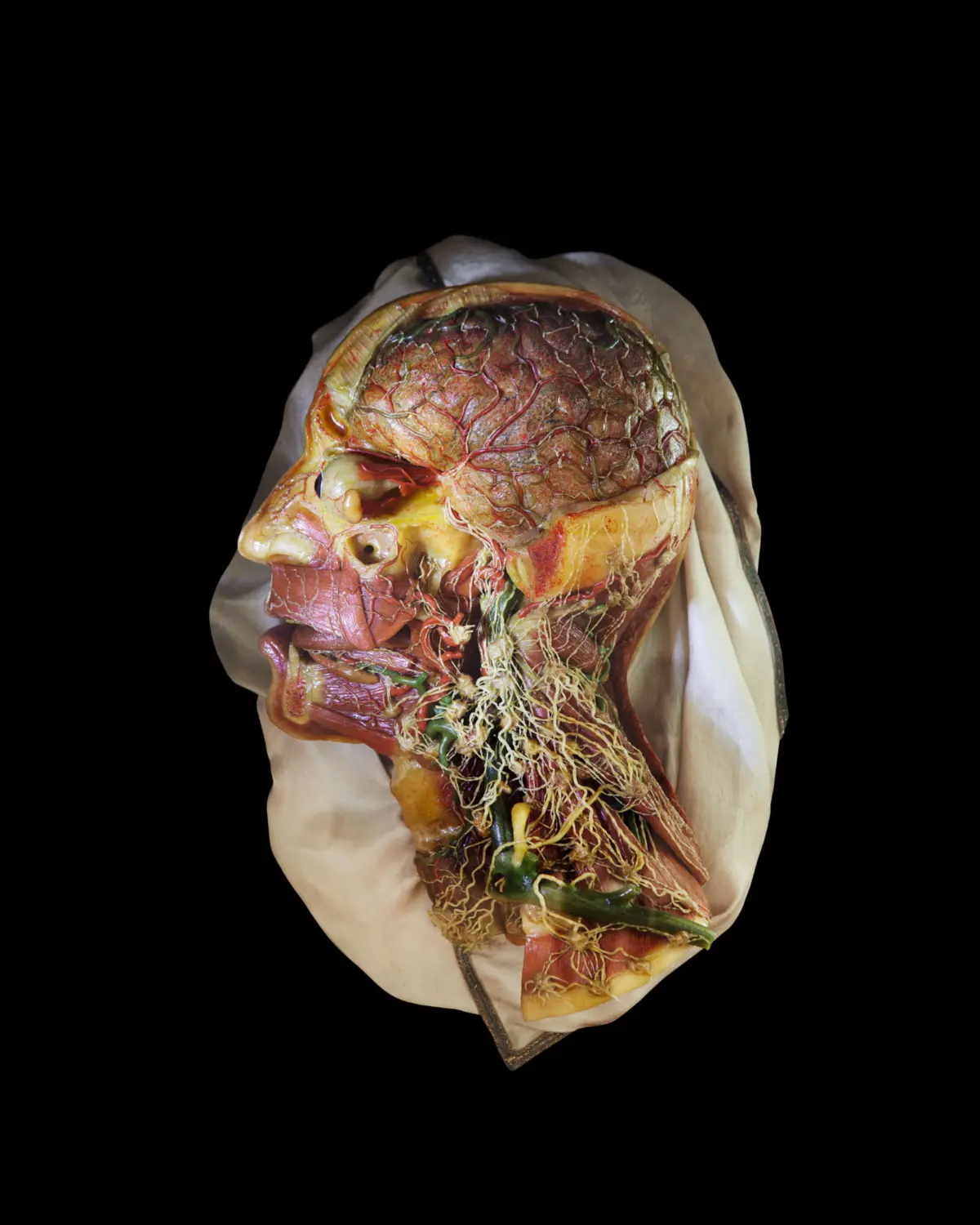 Wax model showing lymph system and blood vessels at the throat, face and brain, for anatomical training. Made in Florence (“La Specola“), around 1781-1786. Josephinum, Collections and History of Medicine, Medical University of Vienna, Austria.
